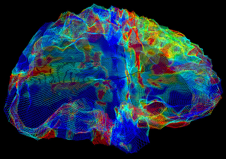 /SVG/new_svg_images/Alzheimers_brain.png