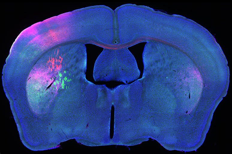 /SVG/new_svg_images/Mouse_mid_brain_fluorescent_tract_tracing.png