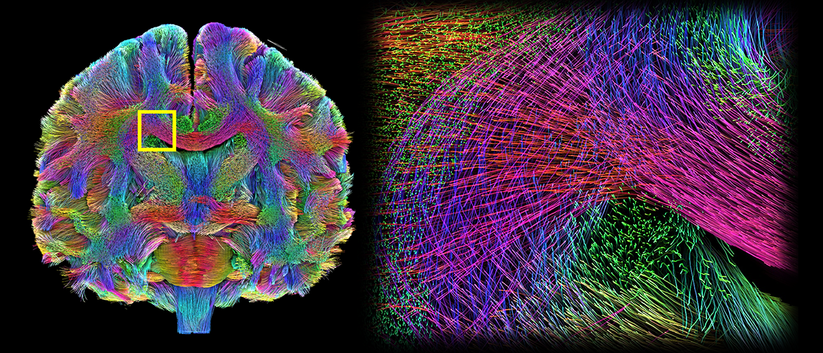 /SVG/new_svg_images/Multiscale_Tractography.png