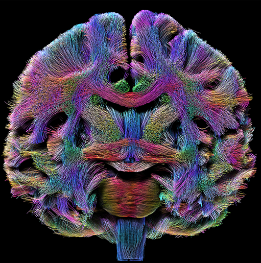 /SVG/new_svg_images/Tractography_Coronal.png