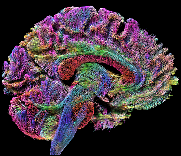 /SVG/new_svg_images/Tractography_Sagittal.png