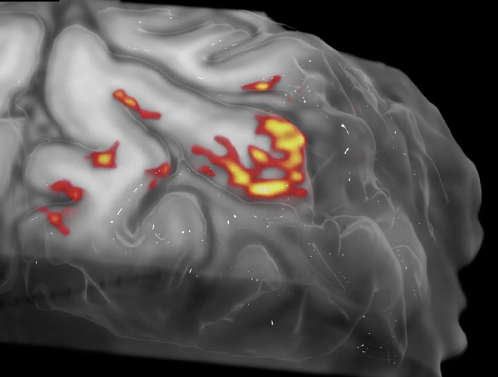 Laboratory of NeuroImaging